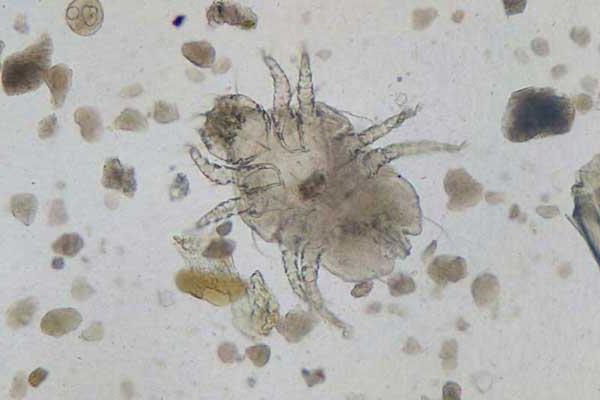 Mite under the skin: signs of its appearance and methods of treatment
