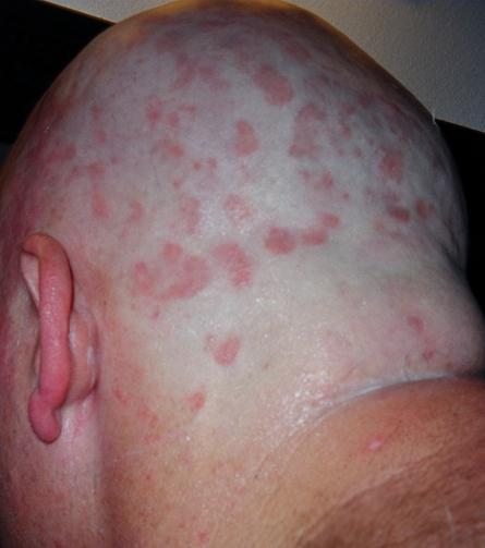 Red spots on the head