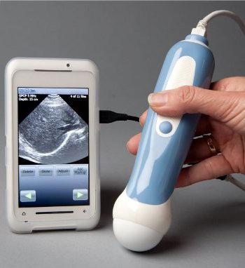 Transabdominal ultrasound is what? Transabdominal ultrasound of the pelvic organs